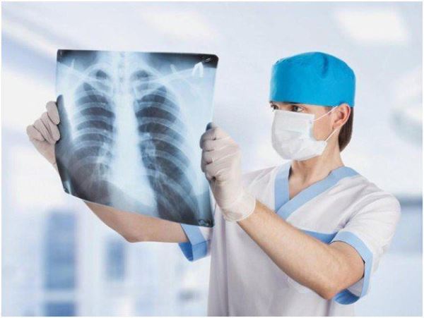 X-quang để đánh giá sức khỏe tim phổi